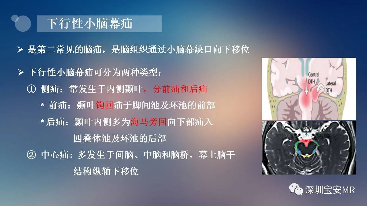 df921fa39e53caf44a225e7cd001b1db.jpg