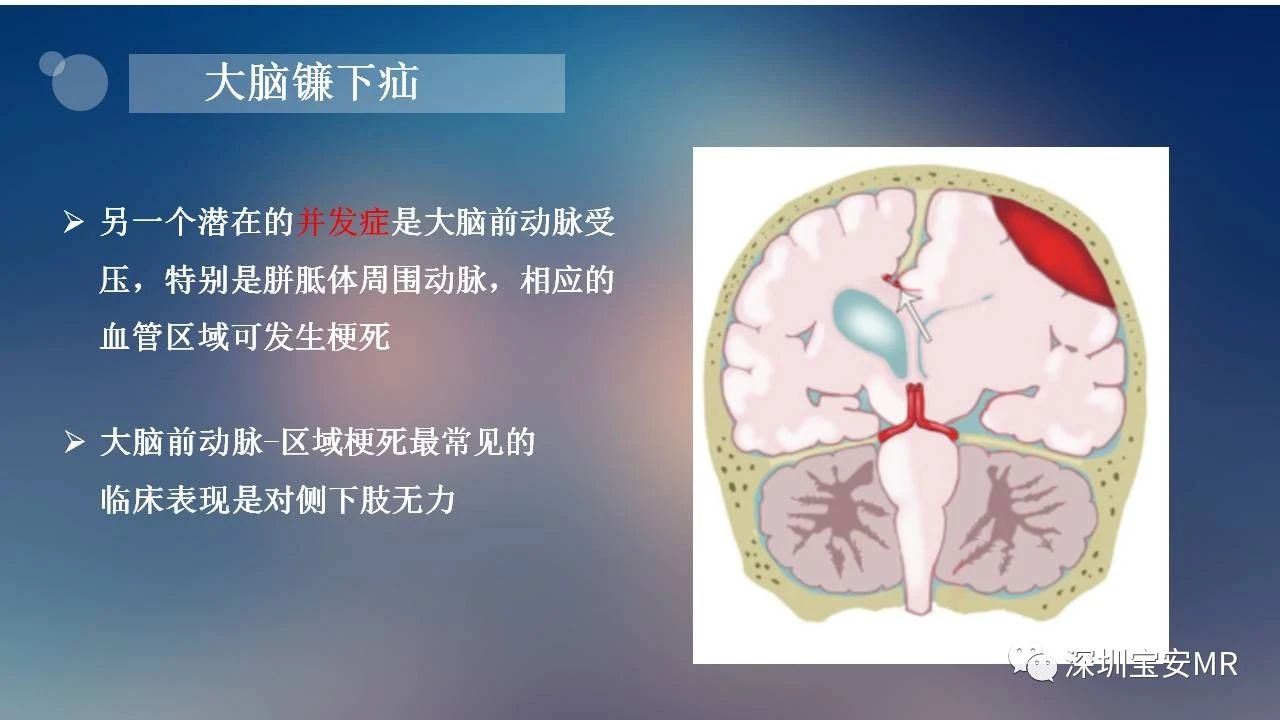 ae067c9f9e55cf42e7d2e0a05ba91132.jpg