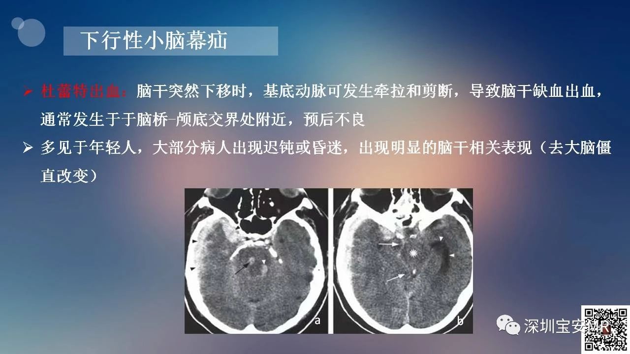 fc4e7532f380d4323b2ea6ed2c285b28.jpg