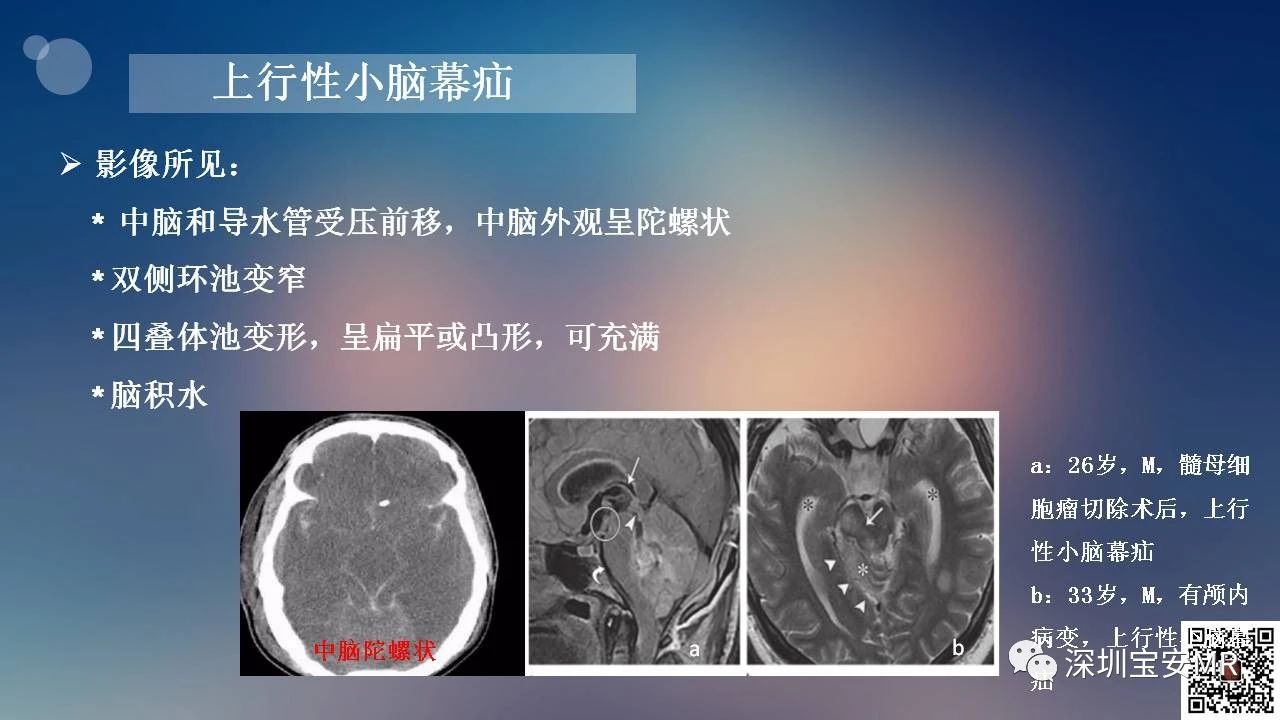965c0ad4ddc1e40fe9c43d06d7d7d937.jpg