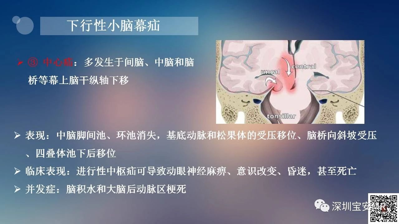 09beafa254ff1f10bee1a476d97c7076.jpg