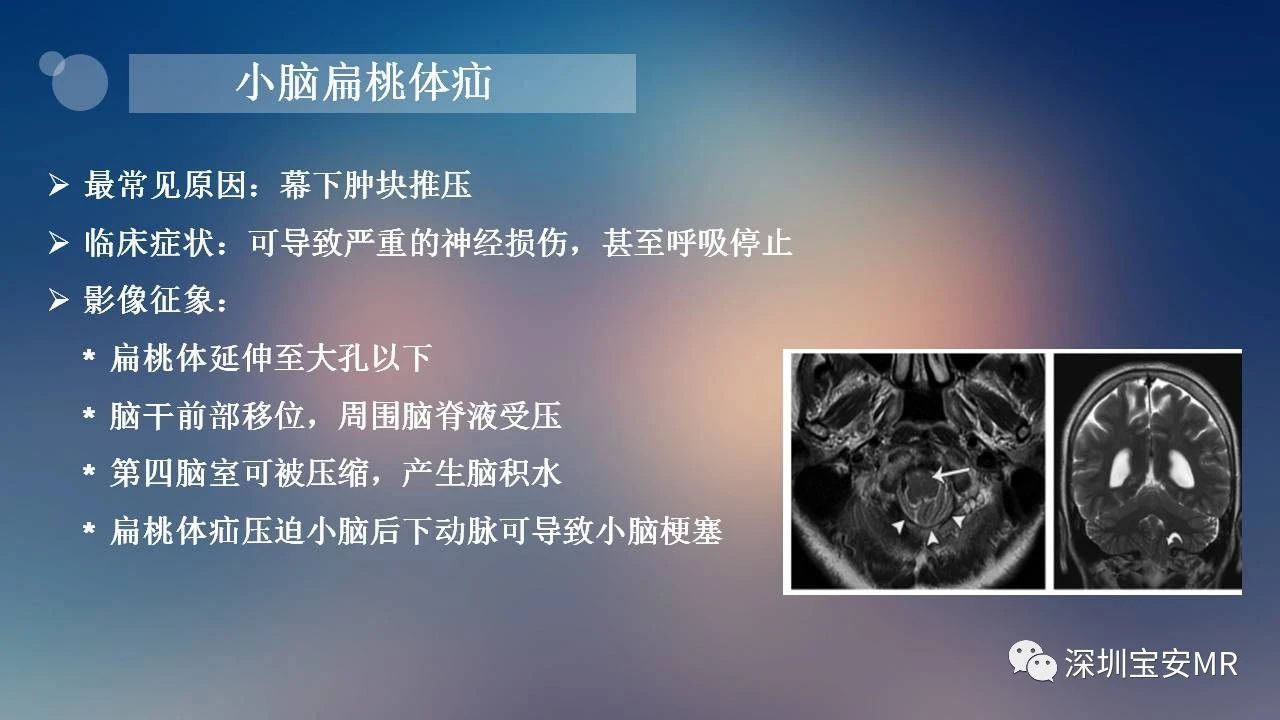 7455a83f46ddaf9201a4c4a4733babd4.jpg
