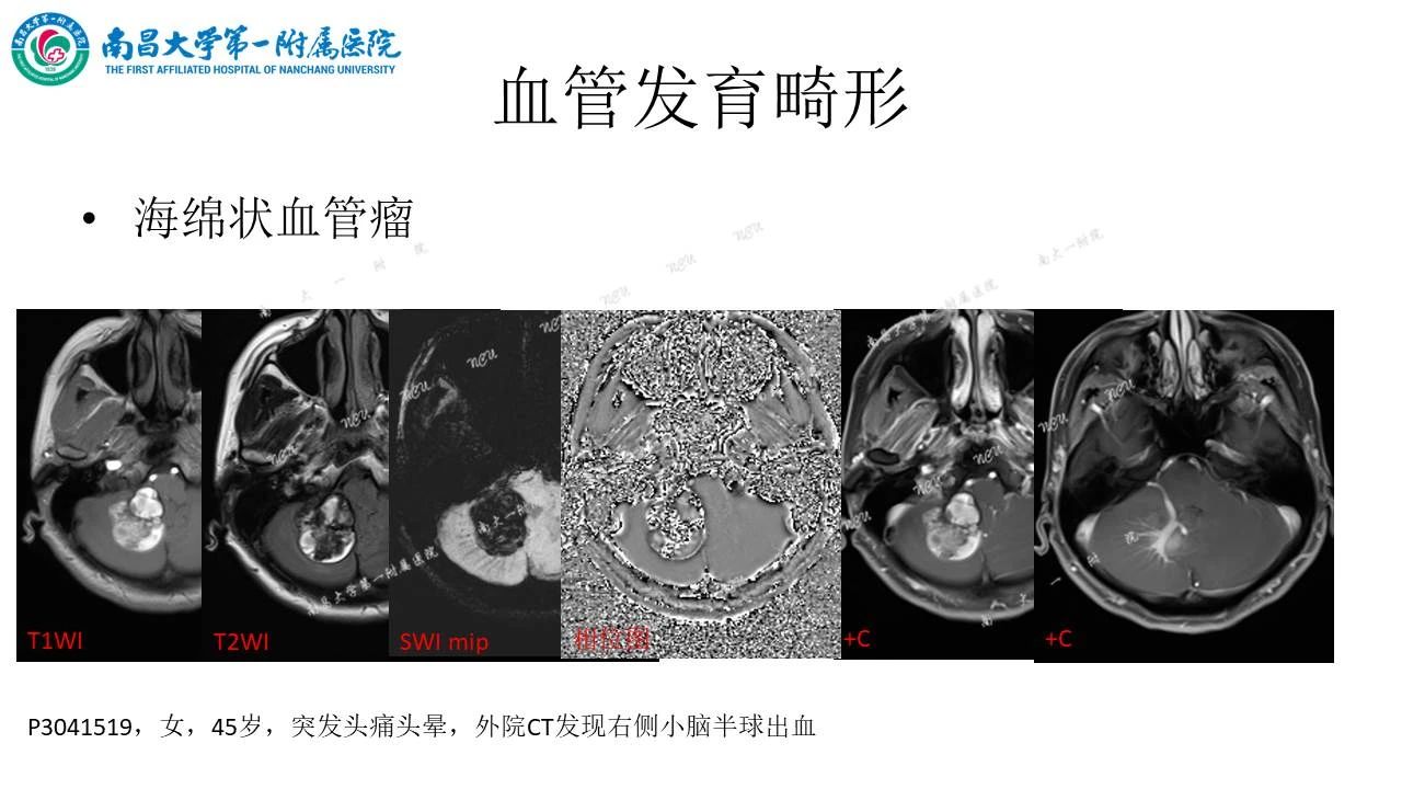 b776caac0017dc2ca05898fcb663c92b.jpg