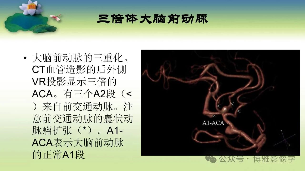 e392021f4dfa23e0ddfcb58b6148bd7b.jpg