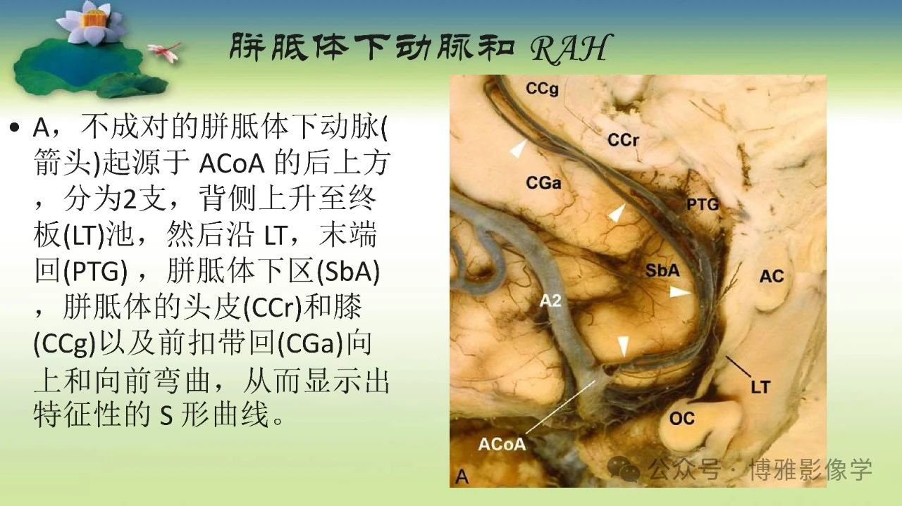 ed2a7338e35383cb45fc73840a9b88c2.jpg