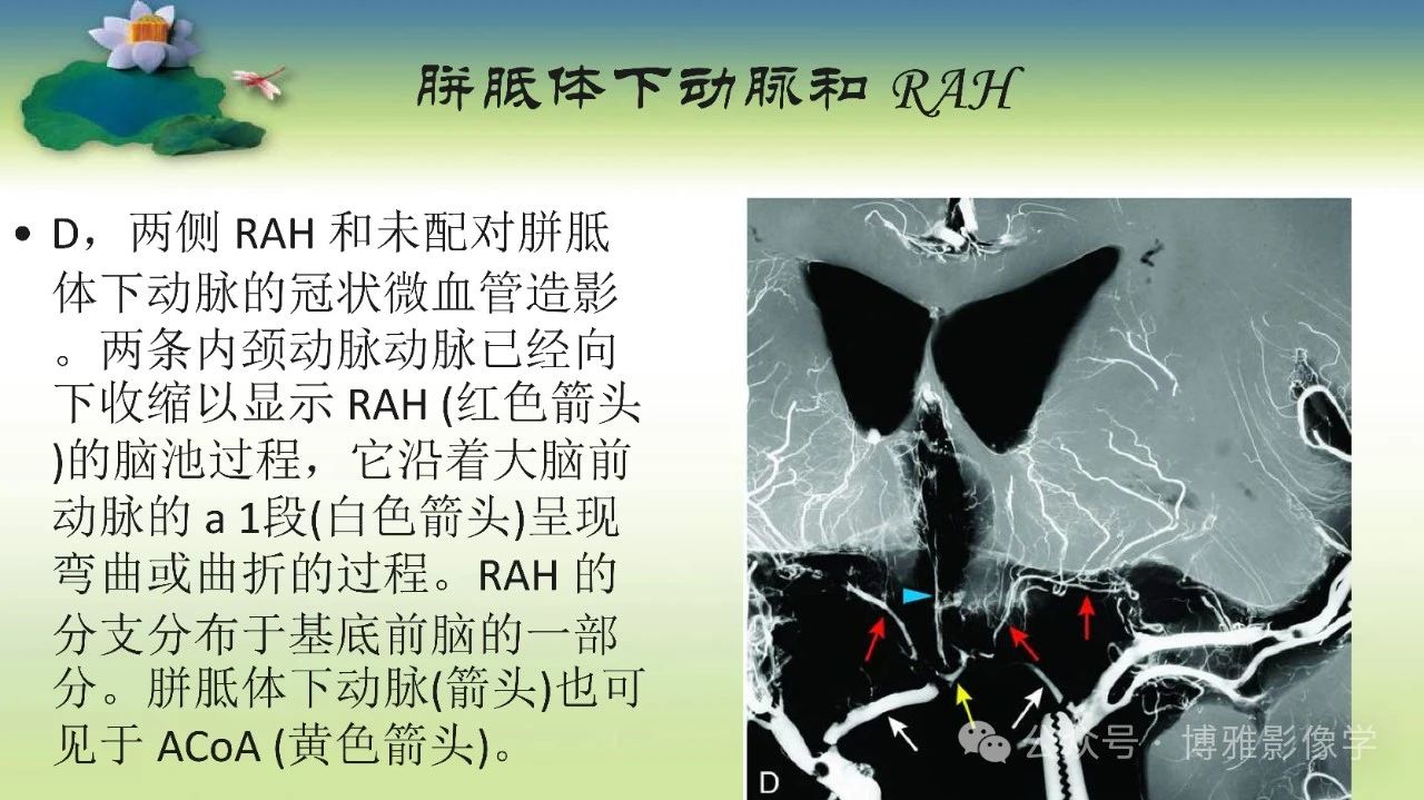 893d5f0b4fb559254992a8049dc92ddd.jpg