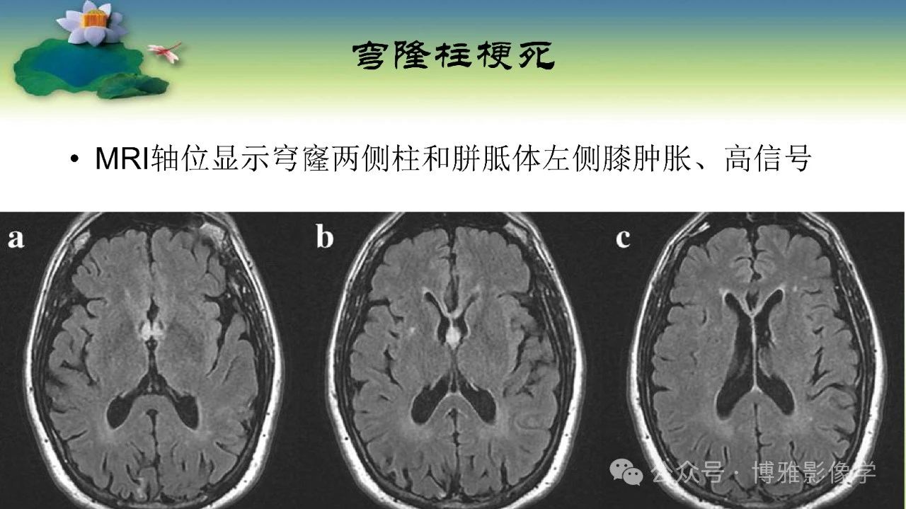 5ada40d2f92e0016b34ae55a9a11dc85.jpg