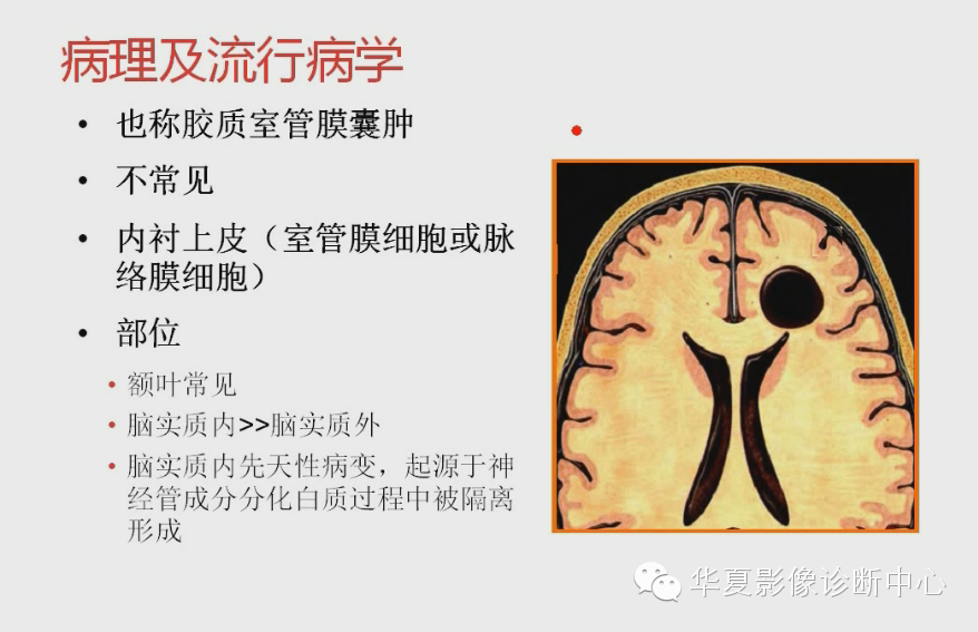 290539a6d0778db0c127de847b3b9e67.png