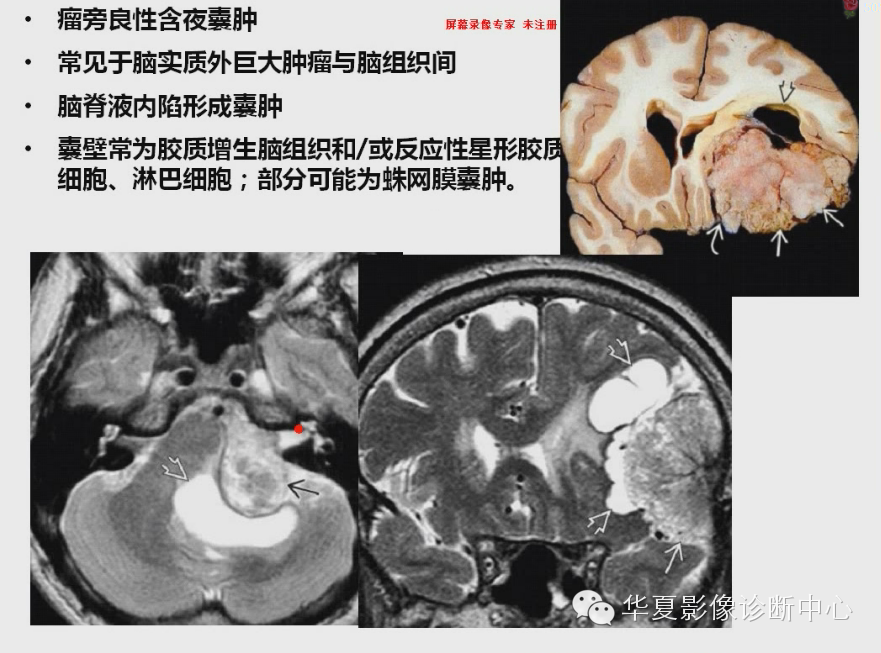 cb89a11192d3f30c884bbc791c794150.png