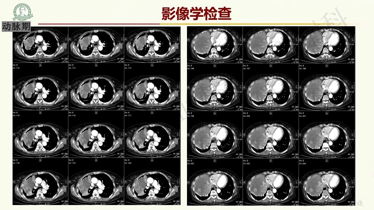 b350f27d306ba9272e2b88711ccb6771.jpg