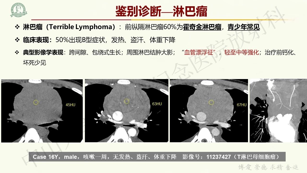 20dfcdcc7ea10731a7ae2730f0df767b.jpg