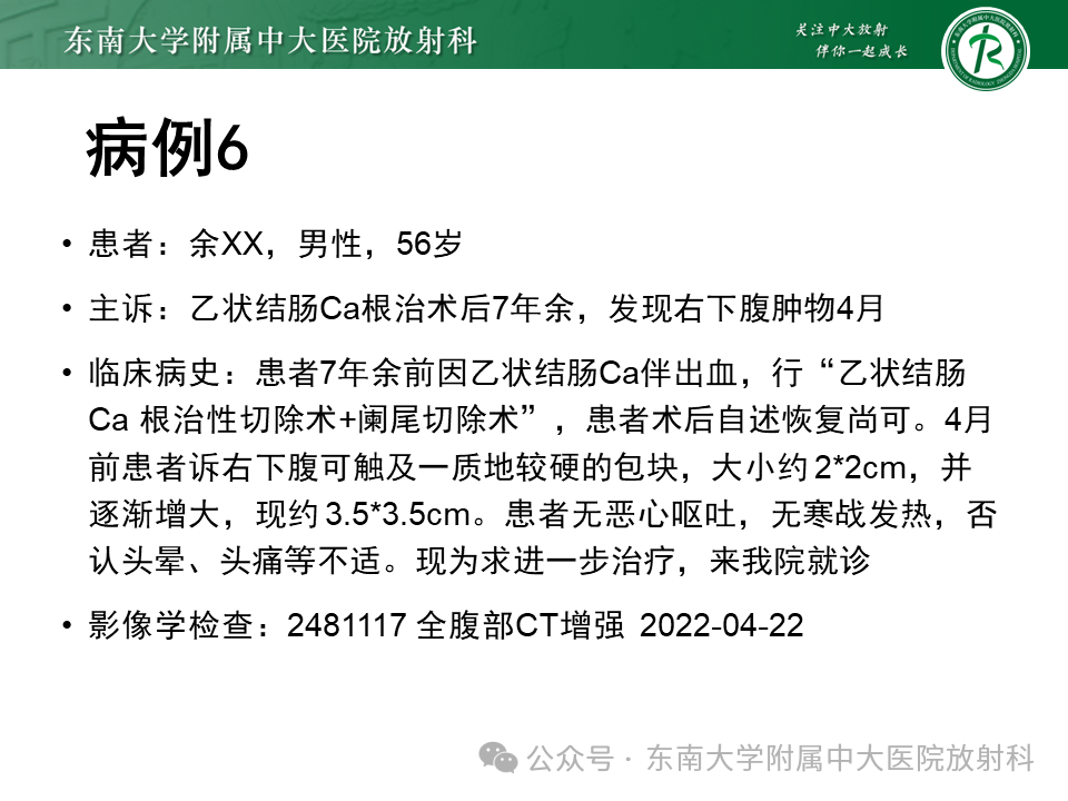 8ce1319be12edddce0244c97db352d73.png