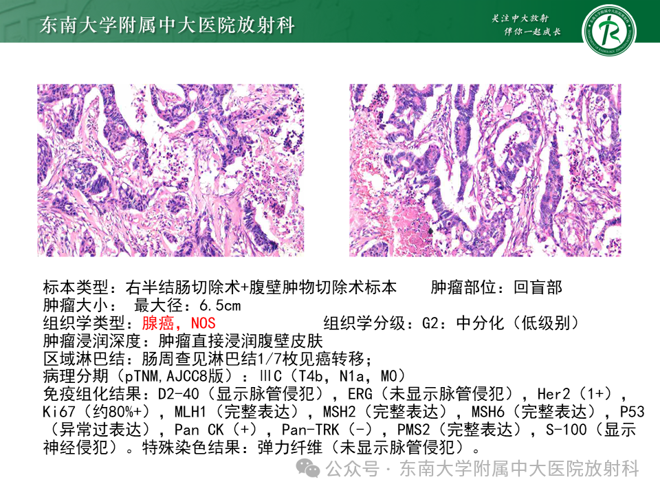 5367eeb59d5677a2c21cb109e1d0d0bb.png