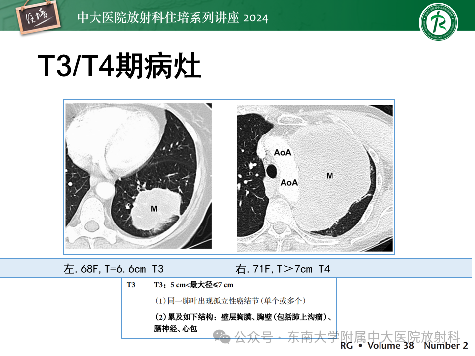 6acf1363b3734f79026e54916ff45d5e.png