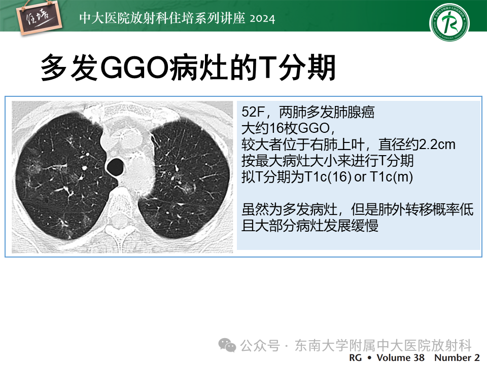 b5403a255a8f51c0001fc2f9334a0b9b.png