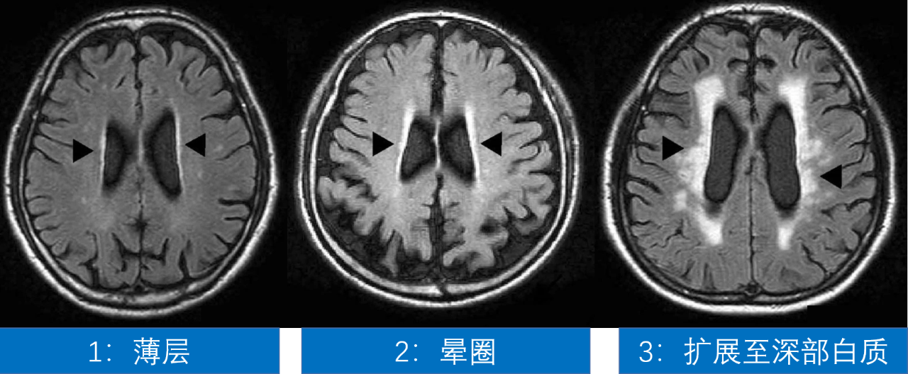 cbdb07cb937d9a8159f3fb472da52ce6.png