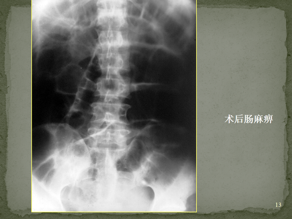 a3cd50045146196a7dfd1cfdc15ffd29.png