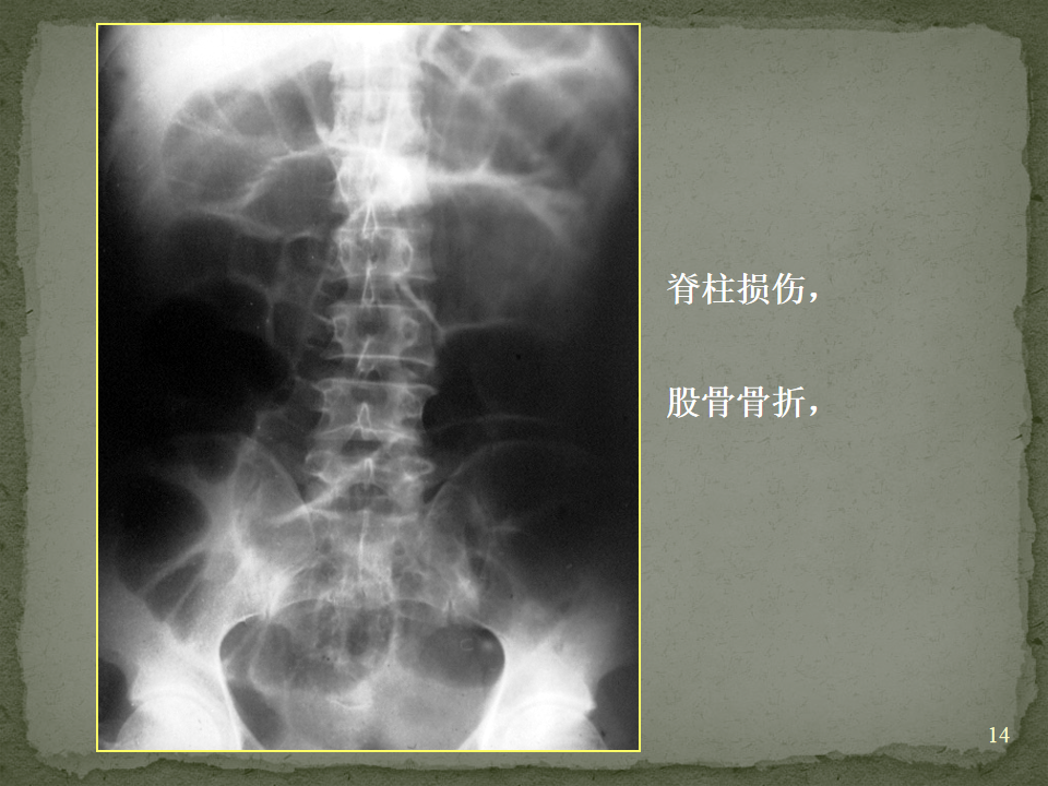 24291ea9c29614e9b0a4ead256cfea17.png