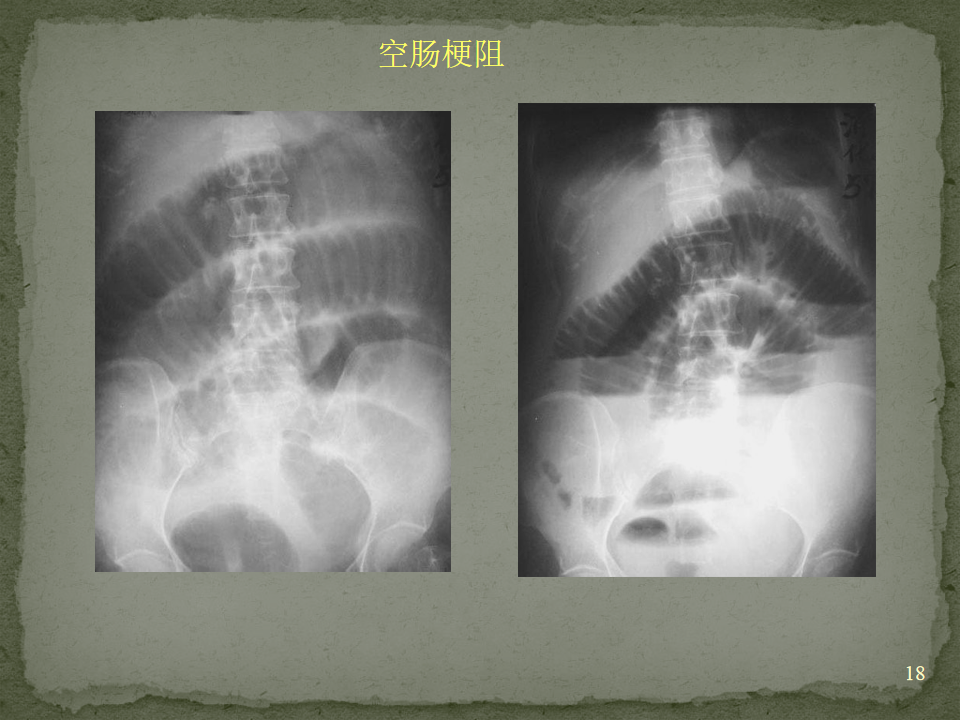 d166f7d6cdf97aa53a1aeb9ca79b4fed.png
