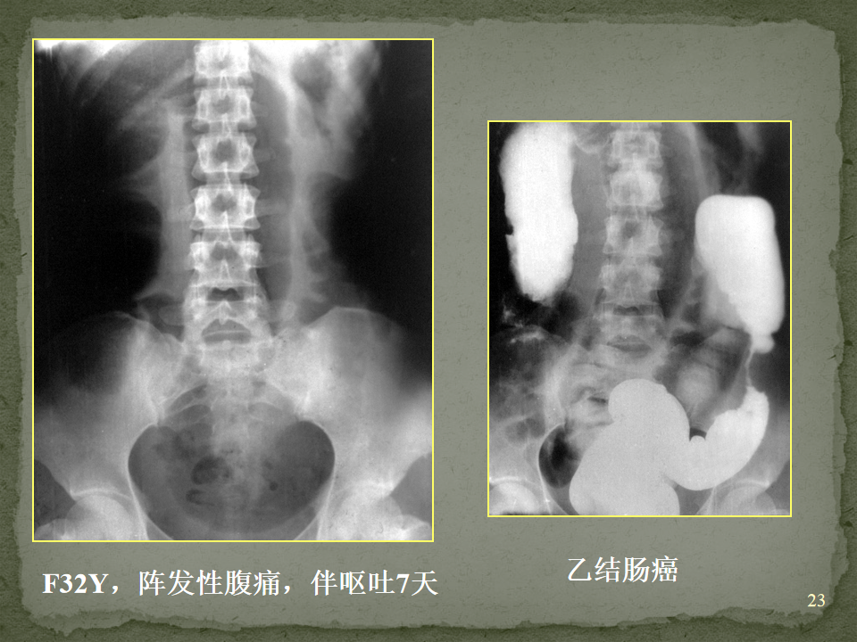 26eab3ded577a451ab0b0ec575c336af.png