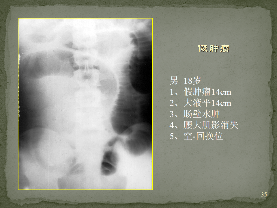 c8cd2b6325391cd36ef4c2c08f00c05e.png