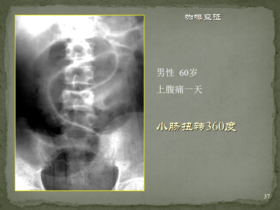 e74aded2d6ded74a49906c3fab4440c0.png