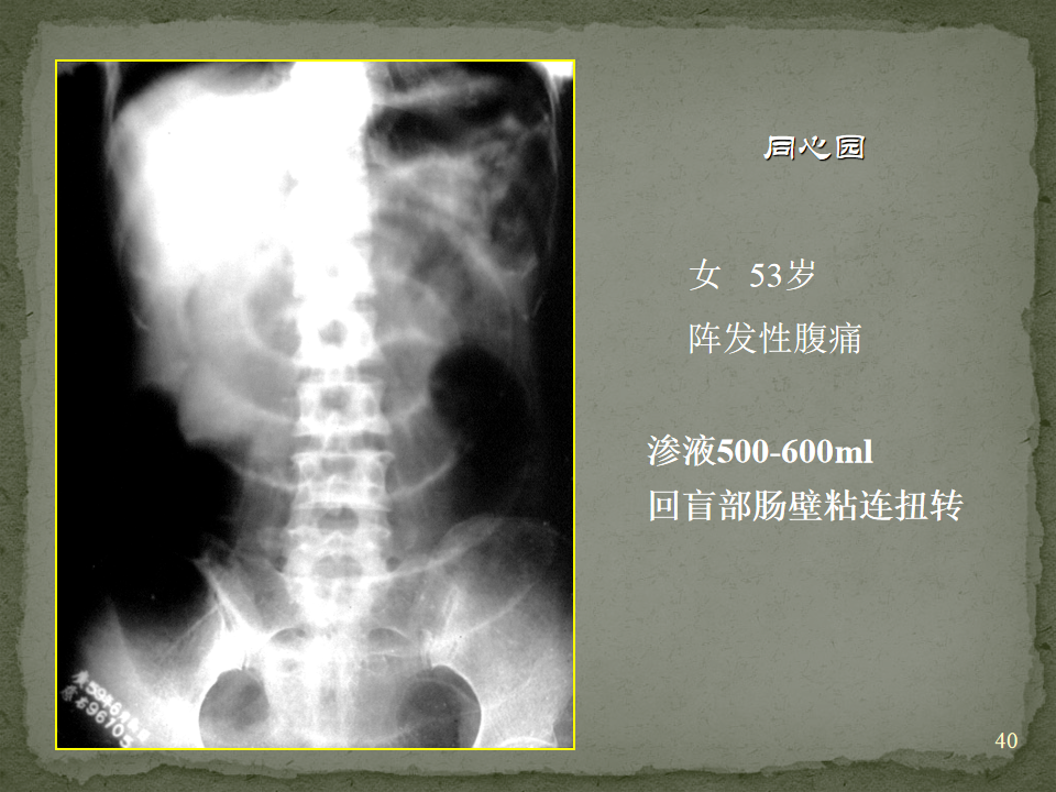 02b627018bbeb28cdcab4a27c9f5b74e.png