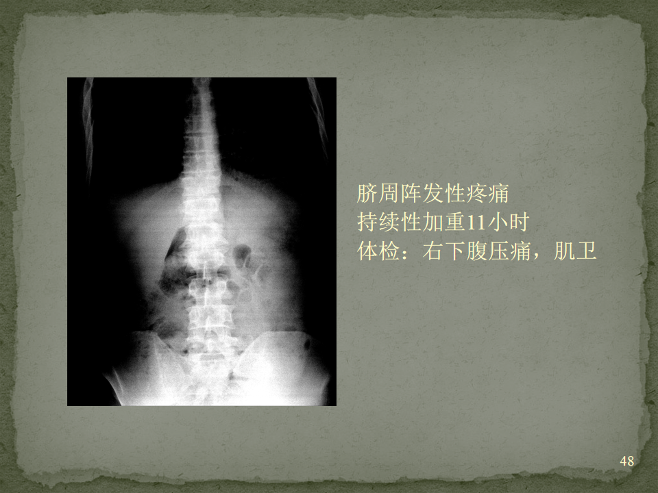 185e285fed8dd204933f76a16a1d723c.png