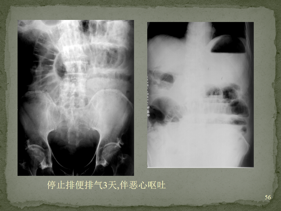 ac79cf735d324ca98a0a51be33854745.png