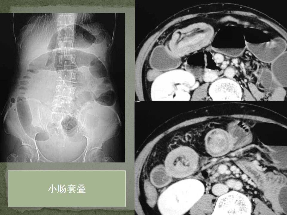 fbb0fca81800498b529b1e8e586434b9.png