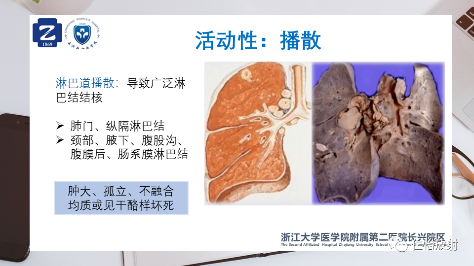 cbf86b00be61294a6d89f15eed4e17d1.png