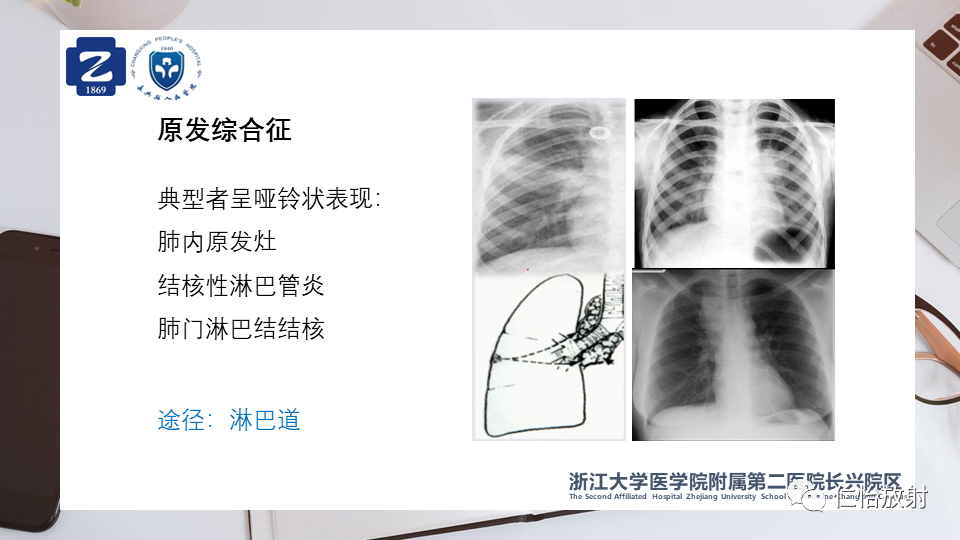 ab0fe051f951860e7818821ac9d26525.png