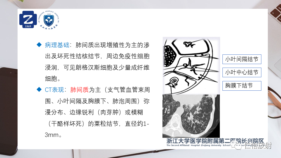 4d6a62facf32d445f6d1288c9475ee6d.png