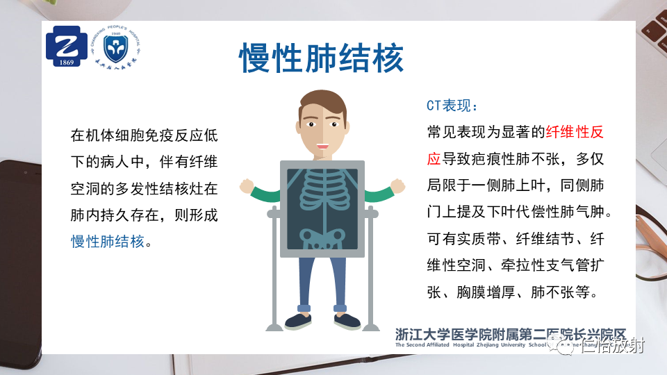 313a942d1a192a4ac250331e837b41f1.png