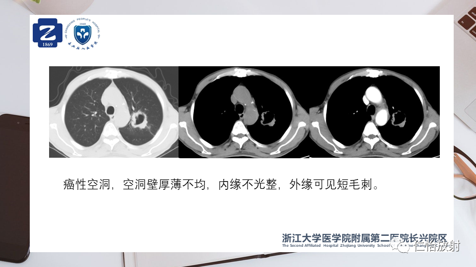 c1004ba1ecbc02c5f0920d9362097cb9.png