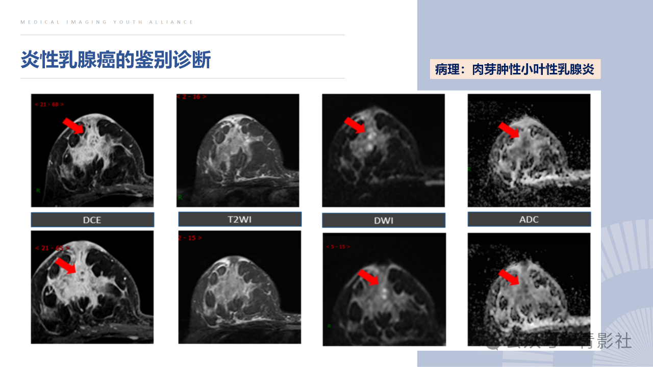 4f6b9ca9f9ccd7f672a661e577895f43.png