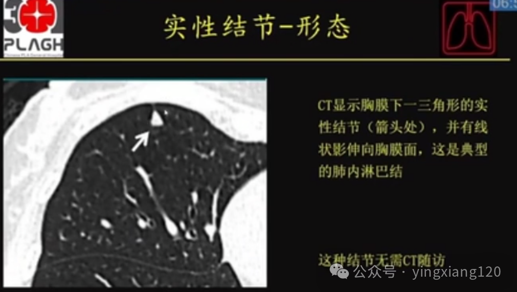 ef57f706d1b8f7a14228d852d50fa50c.png