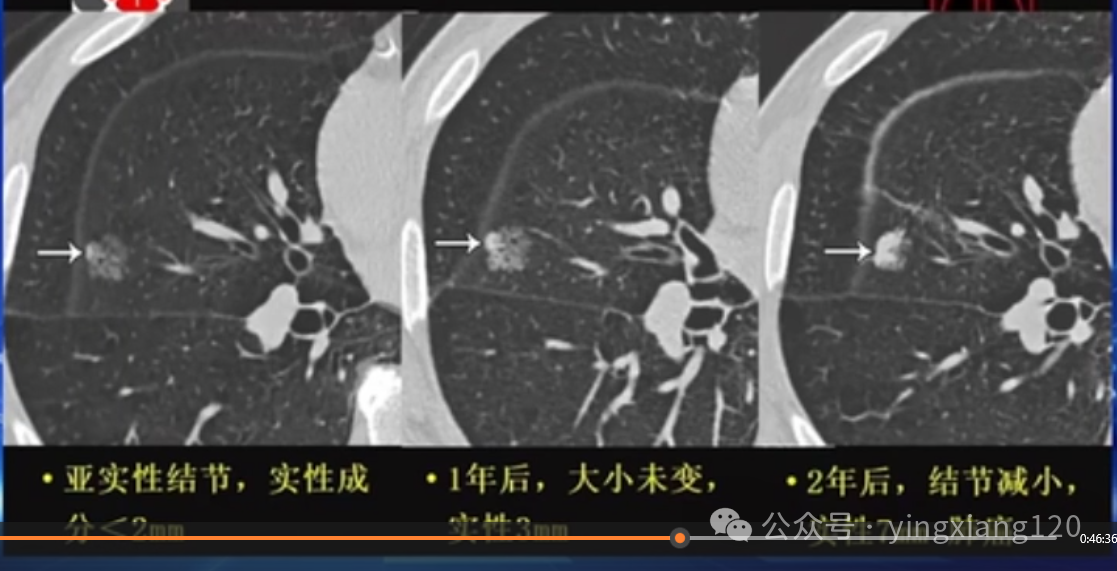 b929498d1df9d2f7eacc5387f482a31a.png