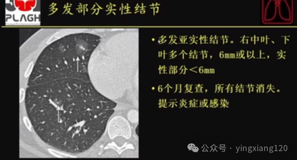 88d020b79c8a4b31776359fe585204a2.png