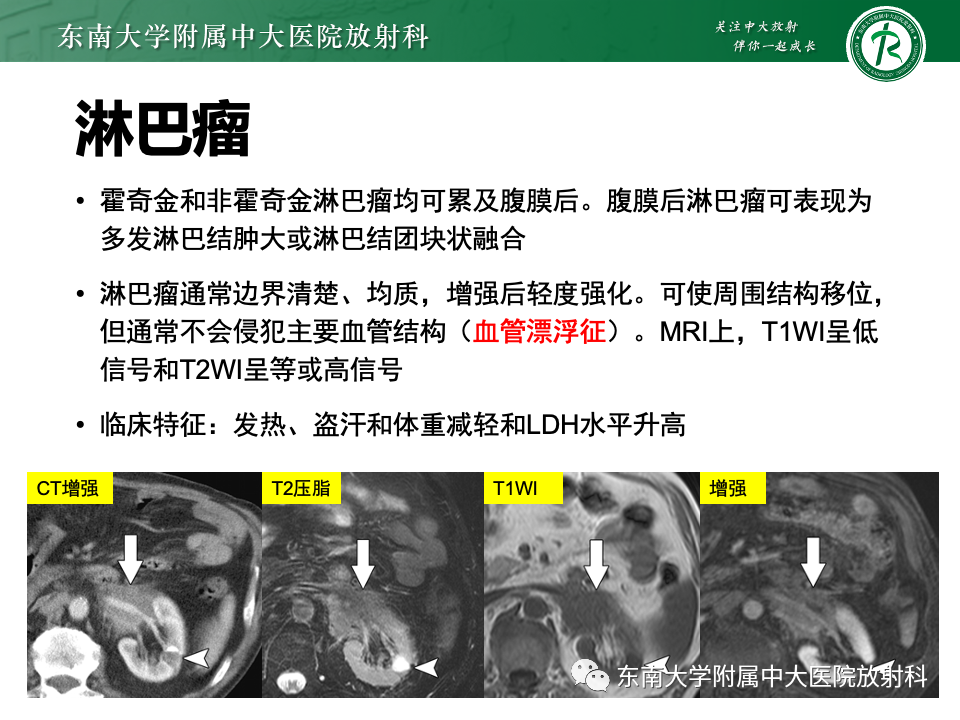 4aaa5d65cec950c8fb125efb1d90bf57.png
