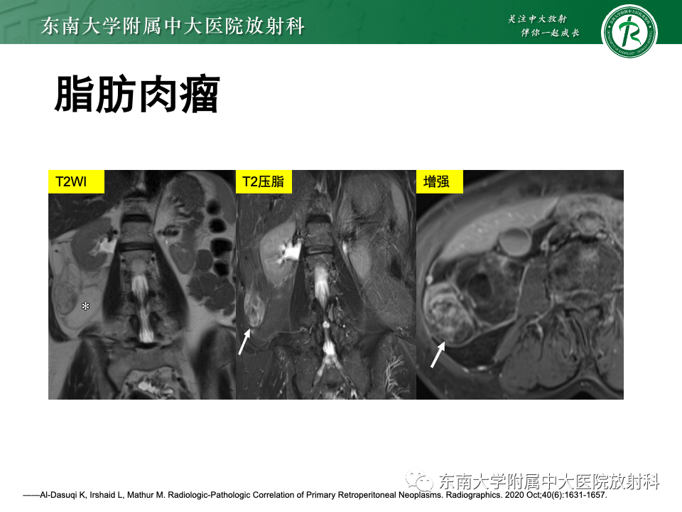 6e161e8abe5aaf51b2a7920e4319ec2d.png