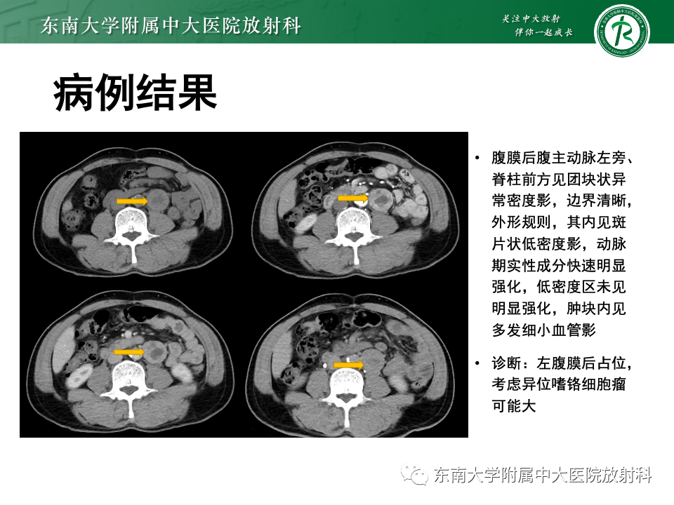 ec964364f28d6e4b88f1a72ff944fa81.png