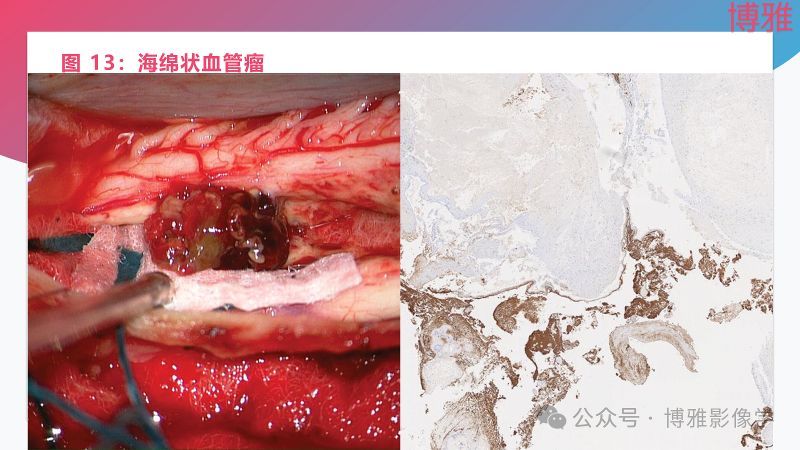 687fbee0795dc337be50f8ce6d4e5ed1.png