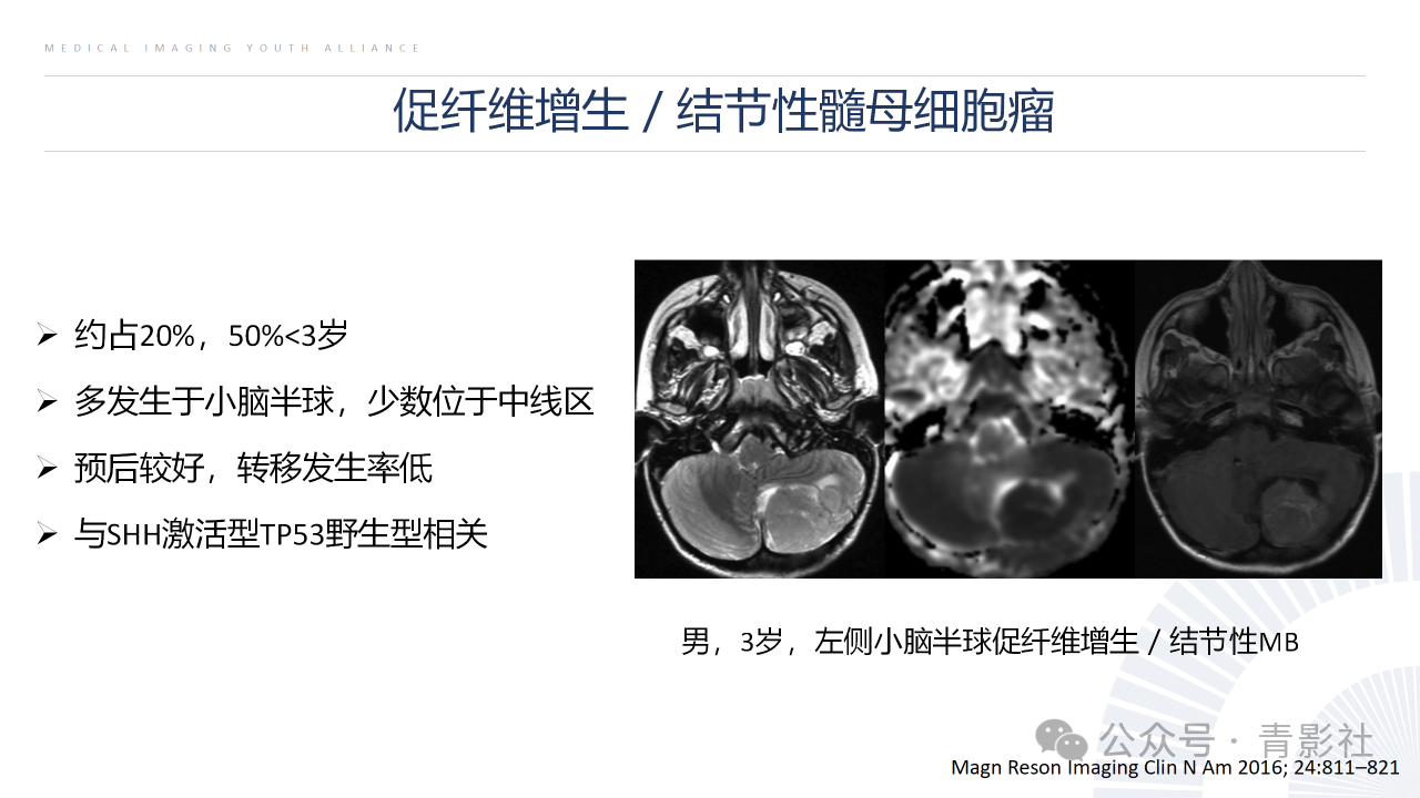 69e36a075ce205889bf55fe07228407e.png
