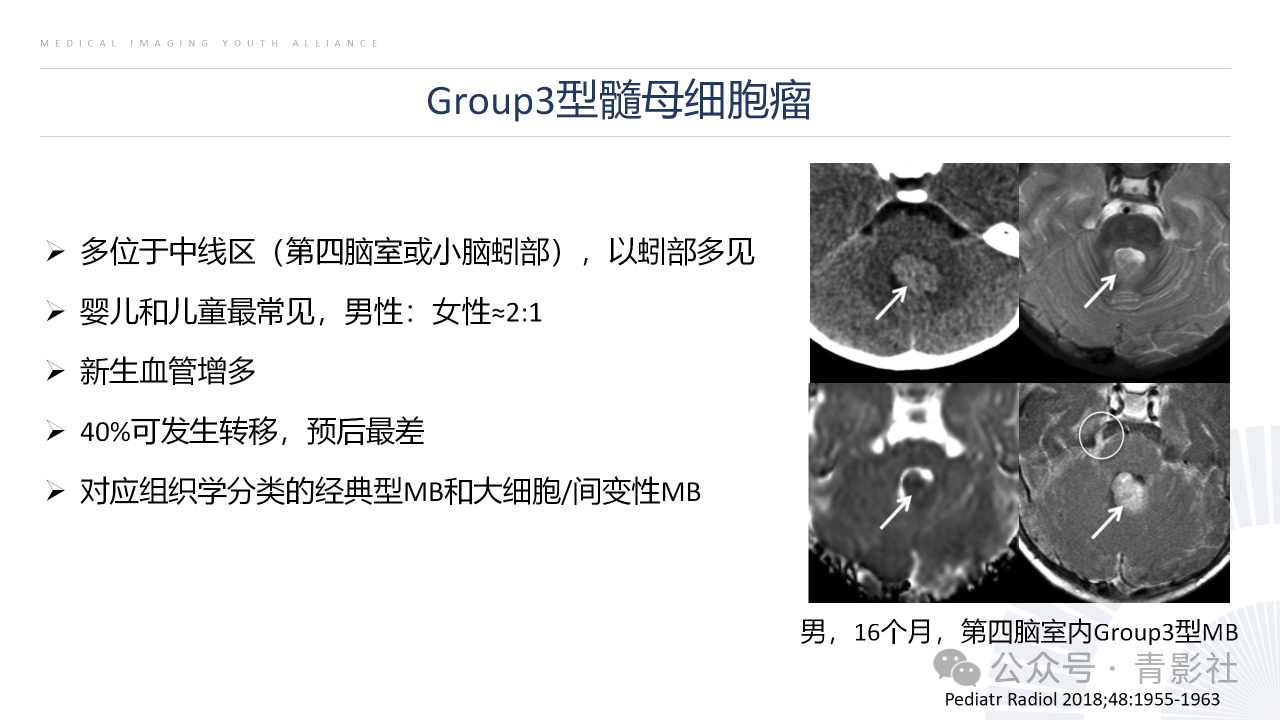 58d8a219830740e3a7a2124ac5958889.png