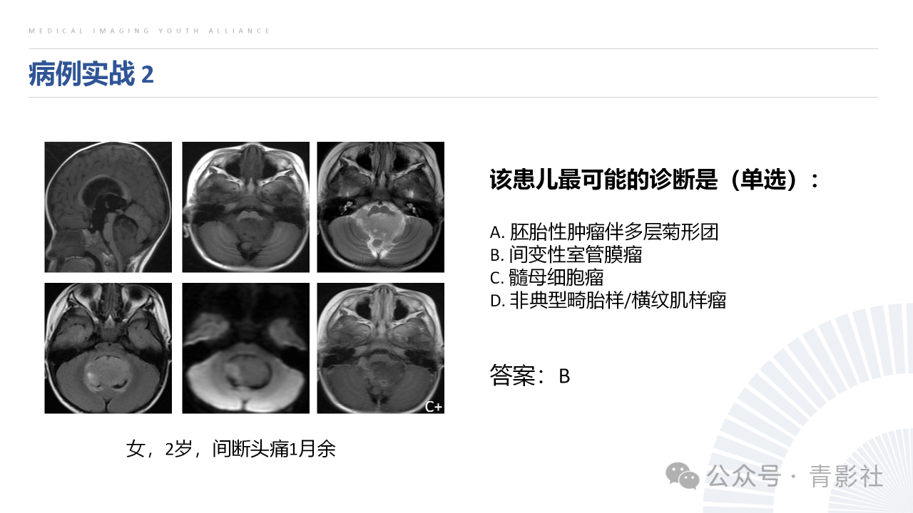 00c360c7e20413ab3c57593f716b9598.png