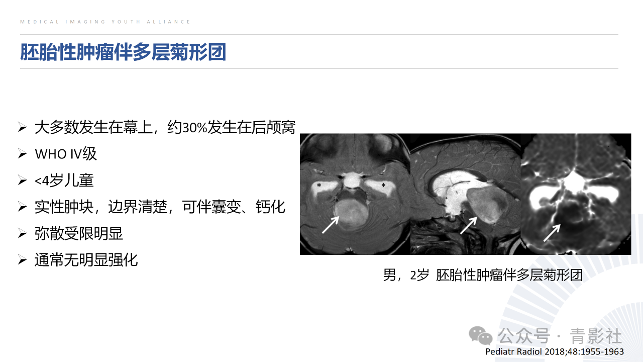 5fc806a88f813bdedb1211c5b83f5712.png