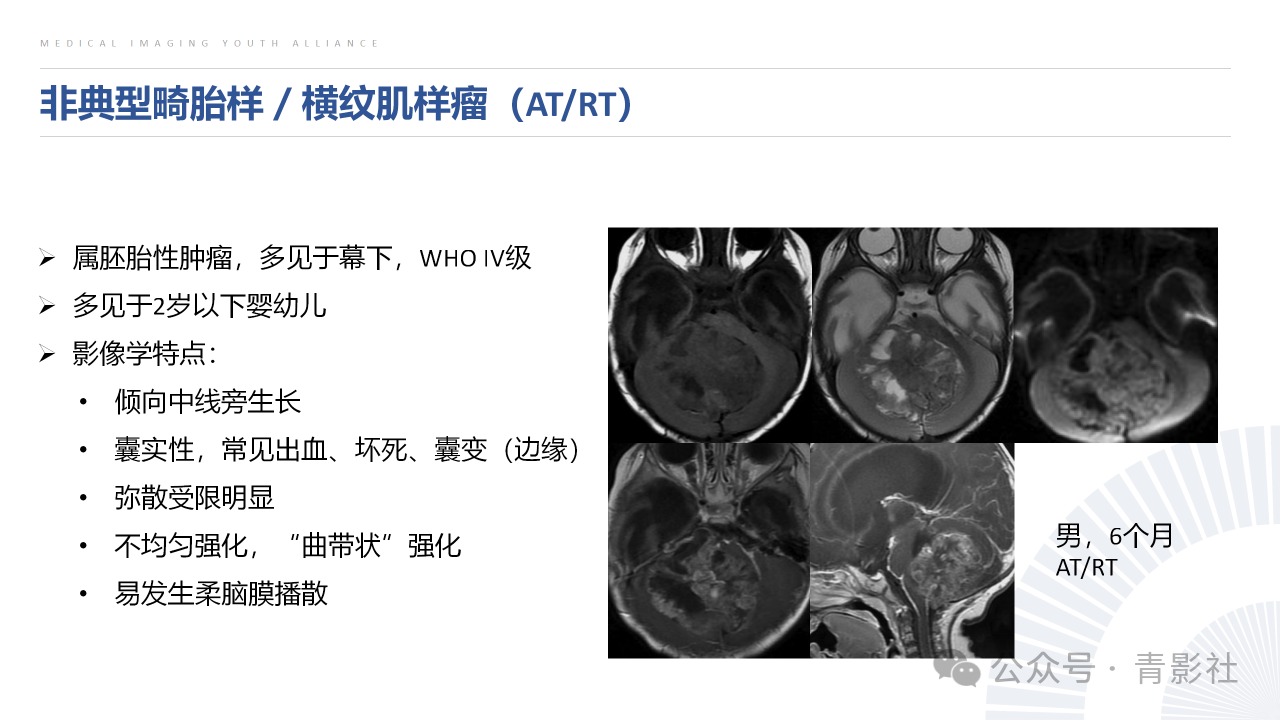 39ac832e898178e2f8d7db5b9fb20361.png