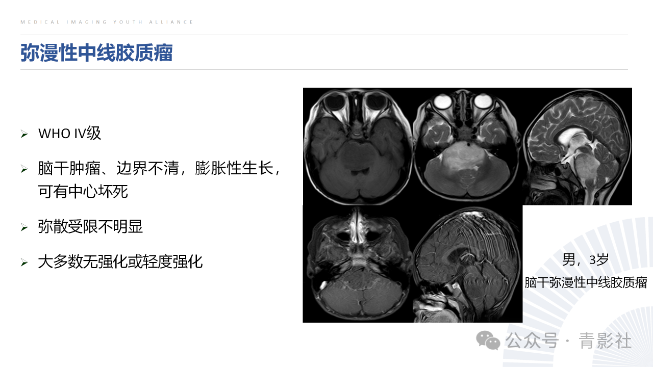 bba2ff189a42087b8bbf0861004ce808.png