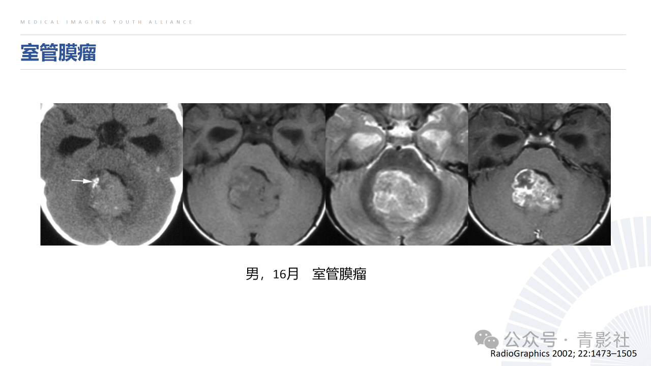 a317adcfcc4ff26431091a2c30418044.png